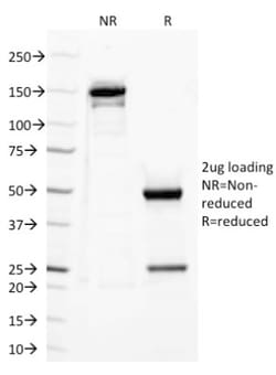 Mouse anti-TLR2, Clone: TLR2/221, Novus Biologicals:Antibodies:Primary